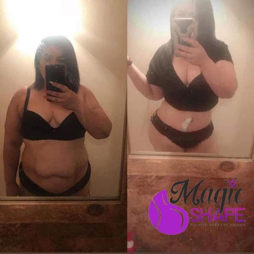 drdagobertomartinez_06