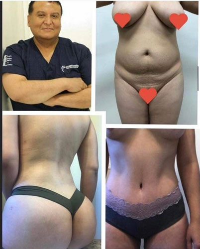 drdagobertomartinez_08