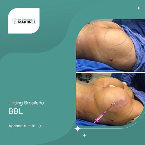 drdagobertomartinez_10