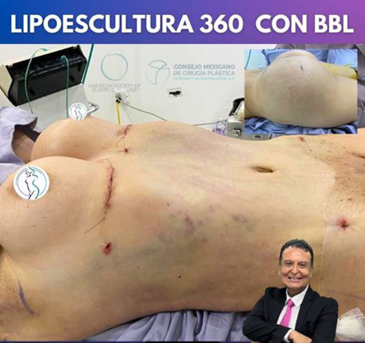 drdagobertomartinez_11