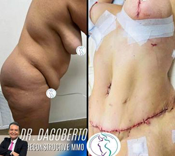 drdagobertomartinez_12