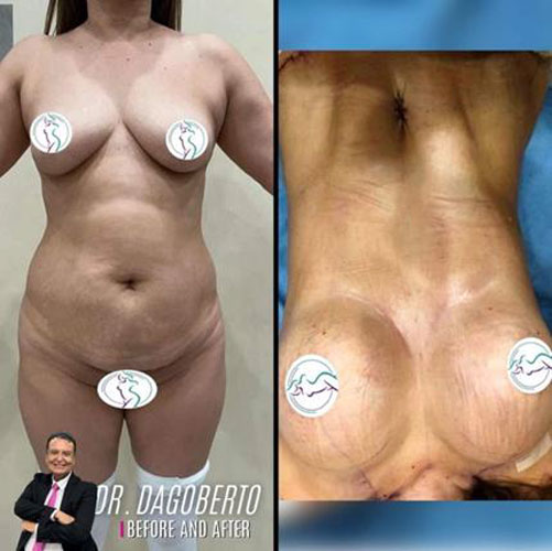 drdagobertomartinez_14