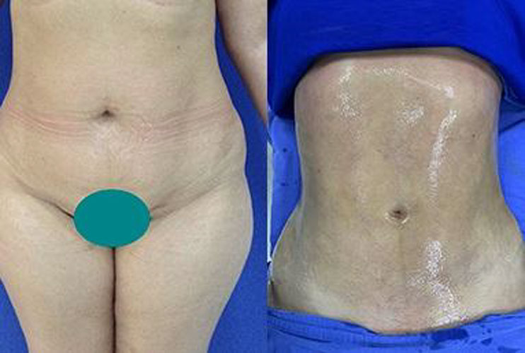 drdagobertomartinez_15