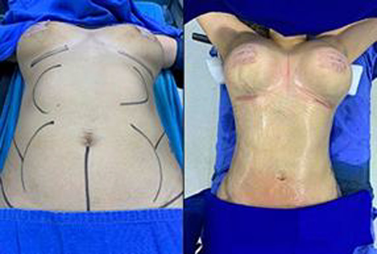 drdagobertomartinez_17